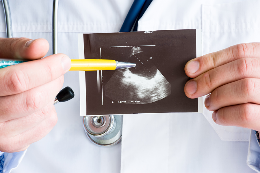 gastroenterologist holding ultra sound result